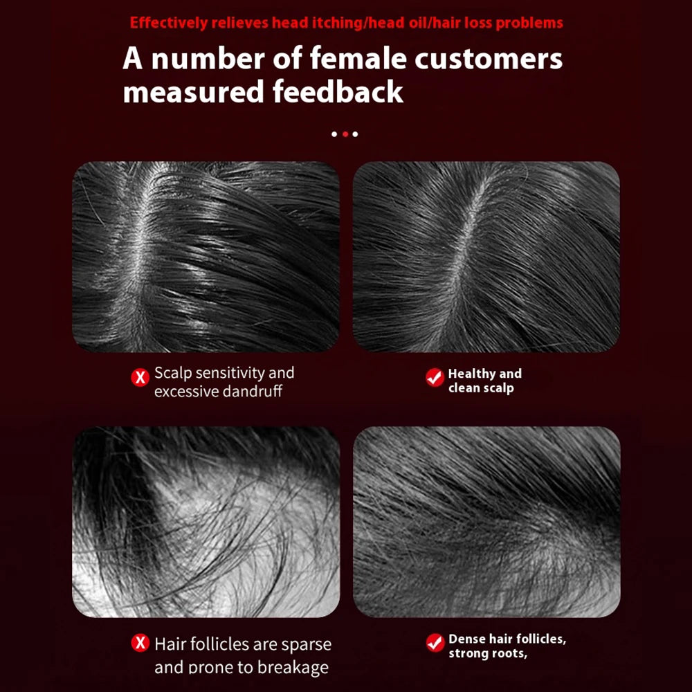 ZENSEA™ Rotlicht Kopfhaut Massagegerät